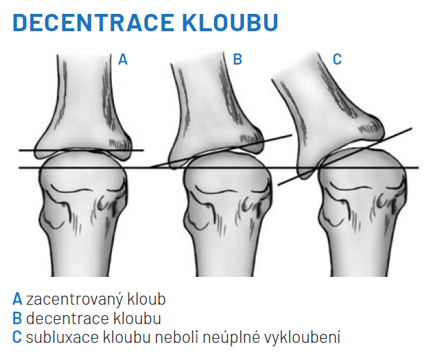 běh klouby