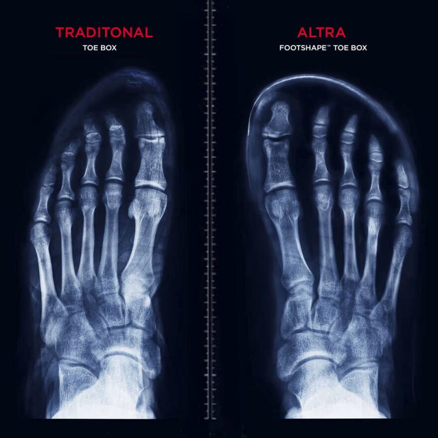 Prsty a celá přední část chodidla musí mít možnost se přirozeně hýbat a roztahovat
